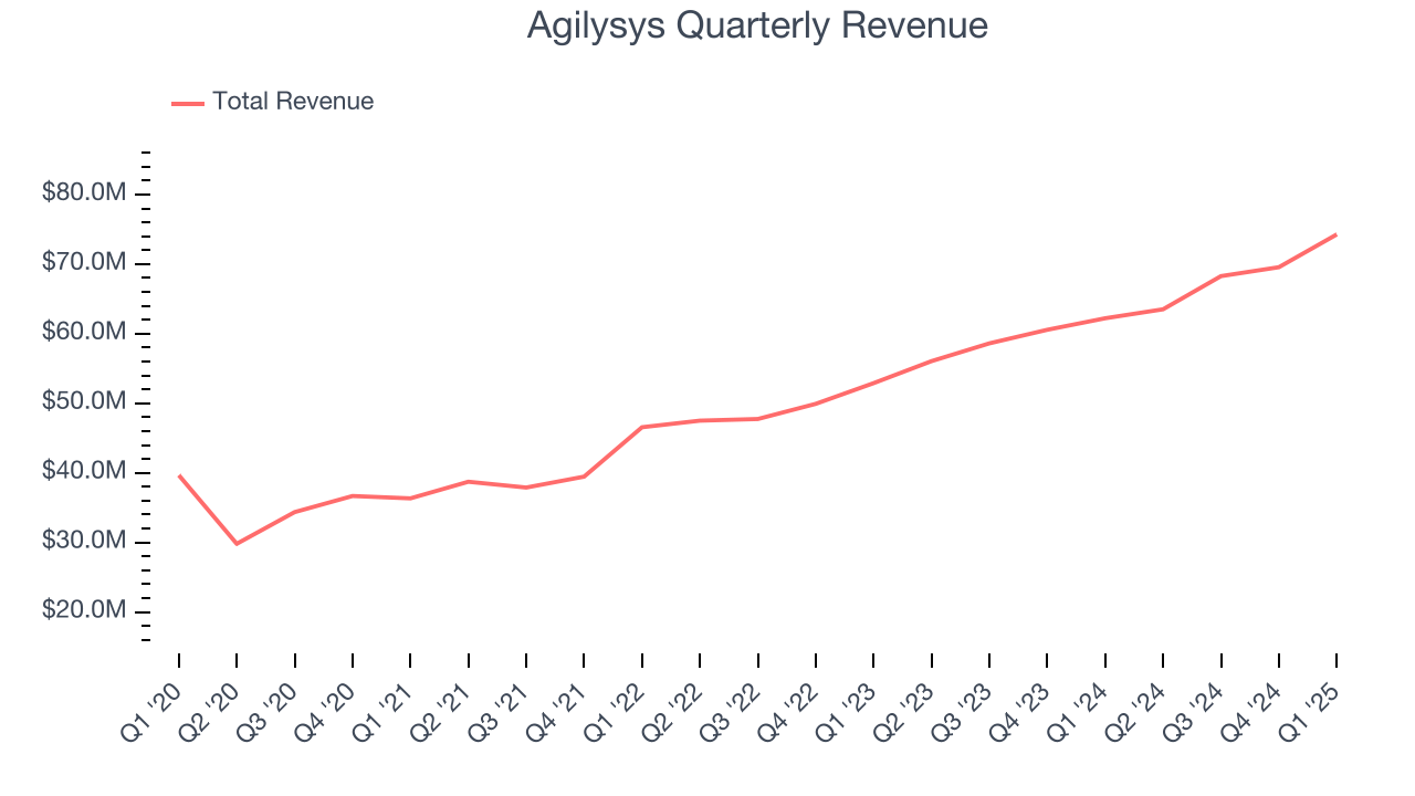 Agilysys Quarterly Revenue