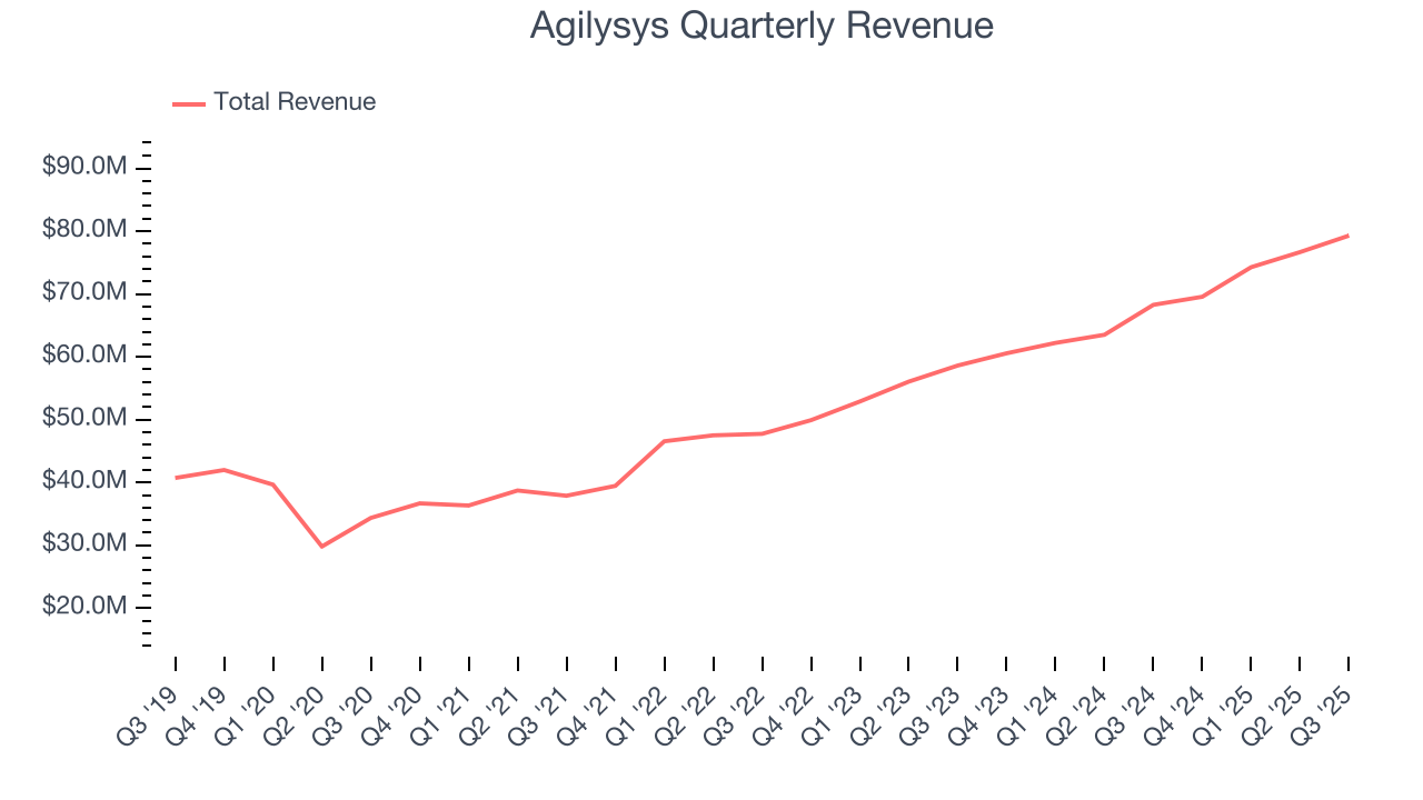 Agilysys Quarterly Revenue