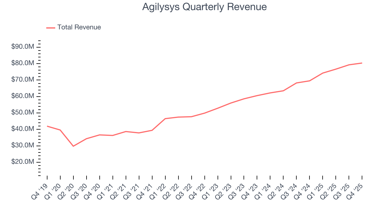 Agilysys Quarterly Revenue