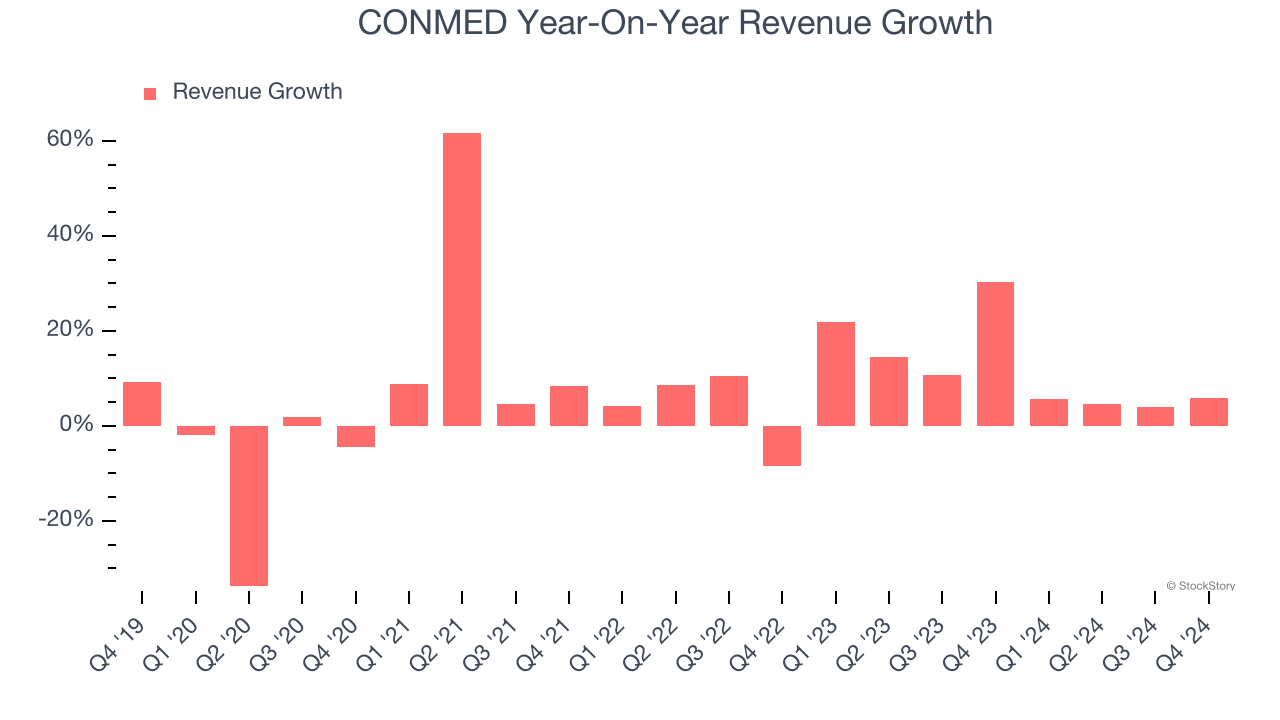 CONMED Year-On-Year Revenue Growth