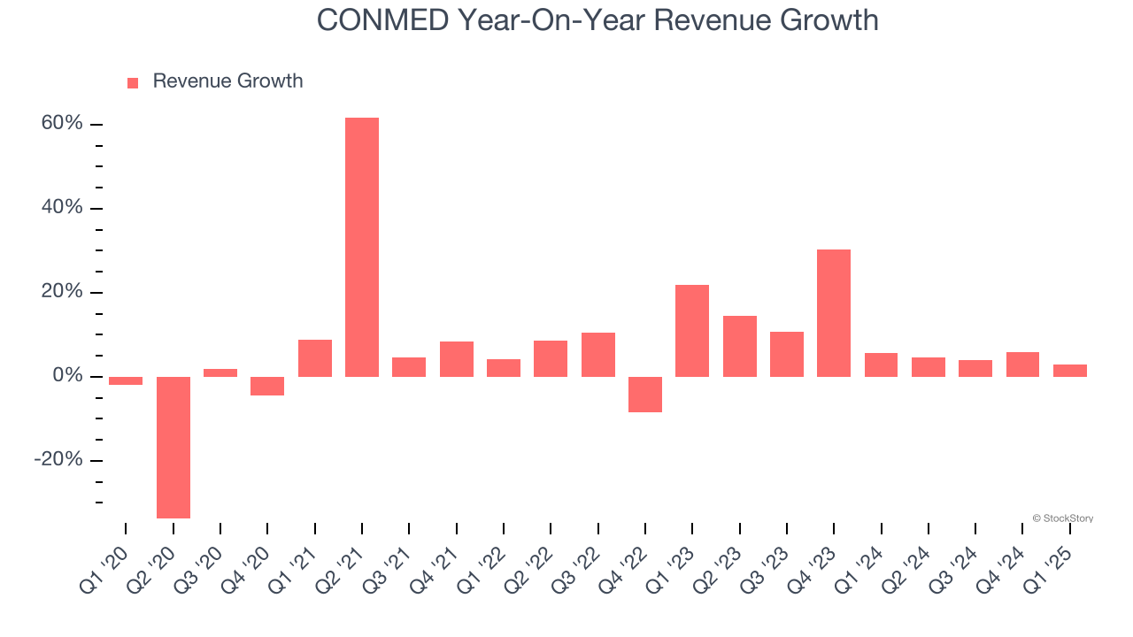 CONMED Year-On-Year Revenue Growth