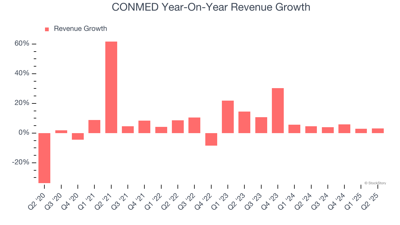 CONMED Year-On-Year Revenue Growth