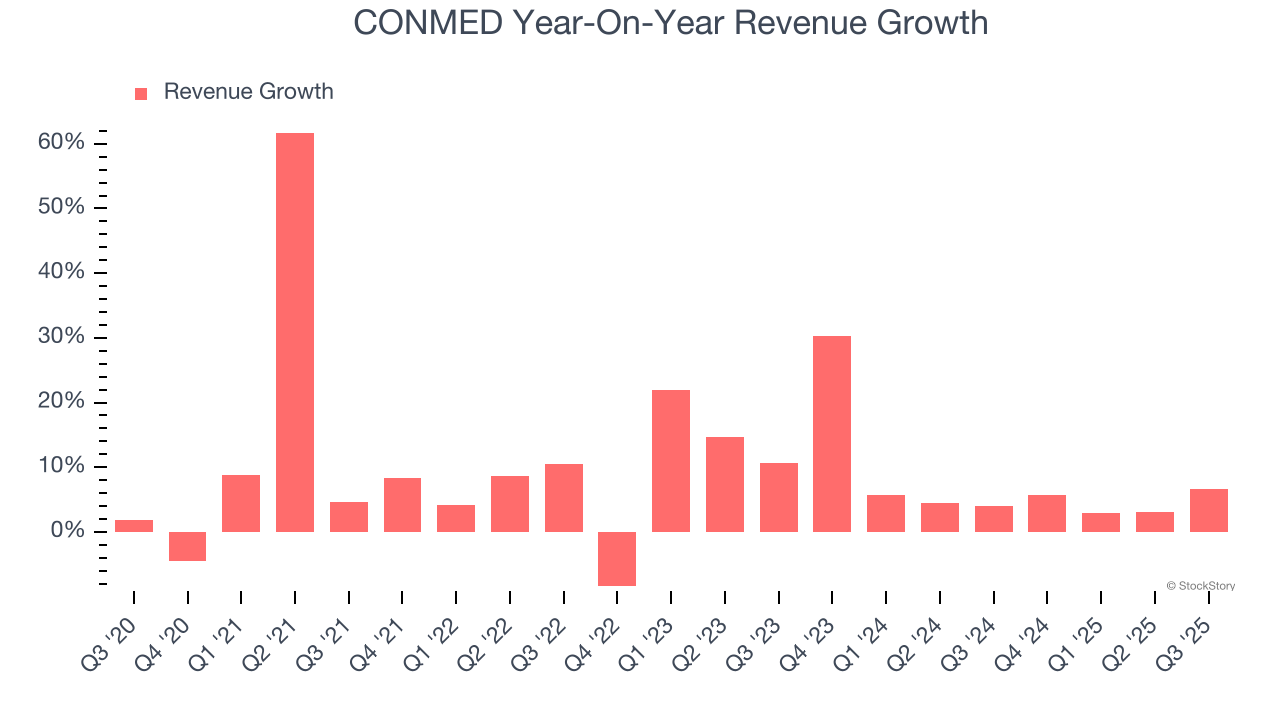 CONMED Year-On-Year Revenue Growth