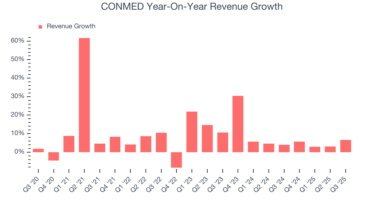 CONMED Year-On-Year Revenue Growth