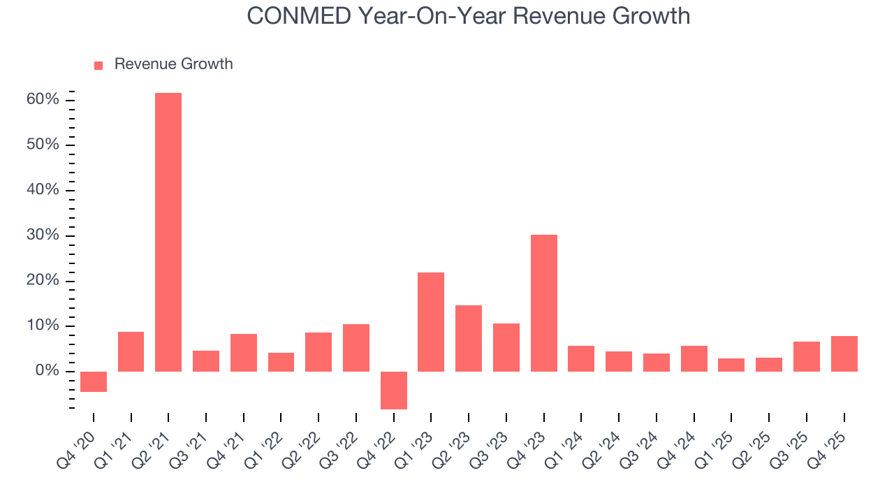 CONMED Year-On-Year Revenue Growth