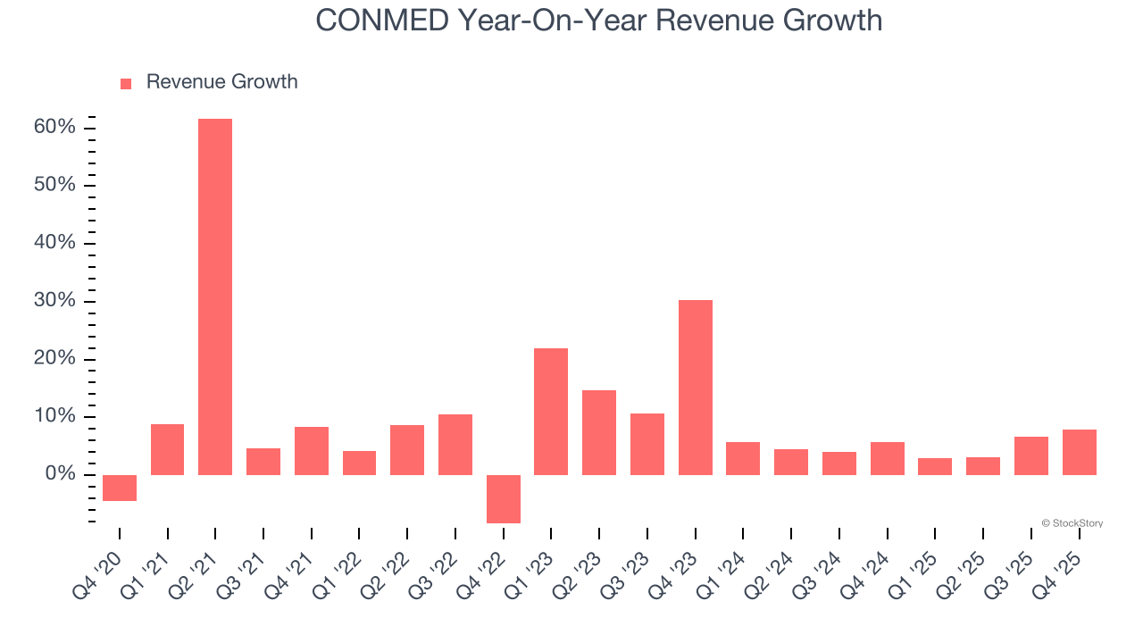 CONMED Year-On-Year Revenue Growth