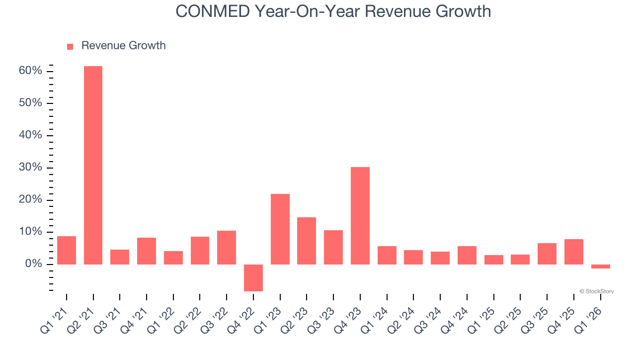 CONMED Year-On-Year Revenue Growth