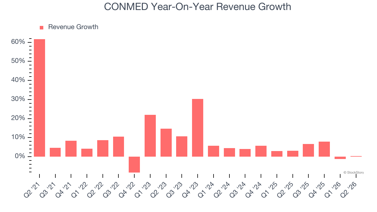 CONMED Year-On-Year Revenue Growth