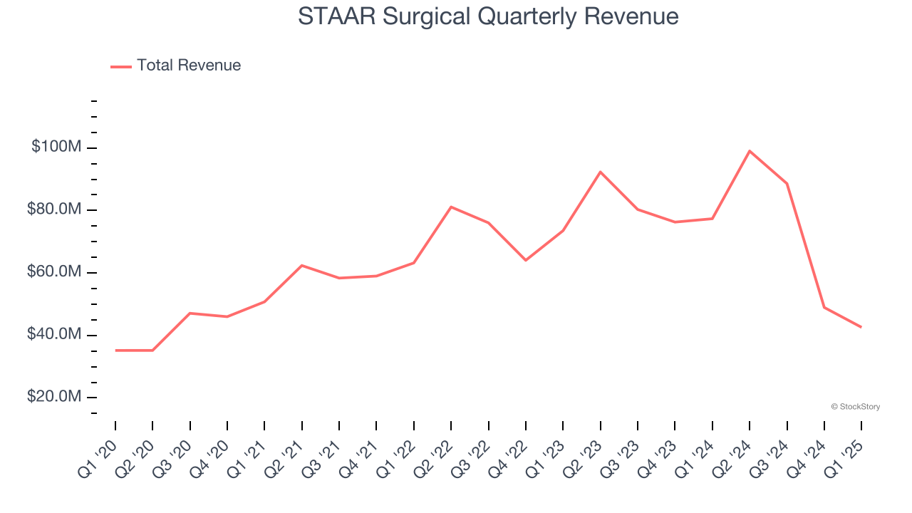 STAAR Surgical Quarterly Revenue