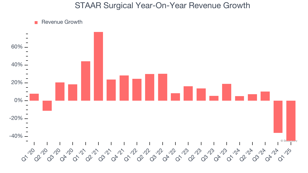STAAR Surgical Year-On-Year Revenue Growth