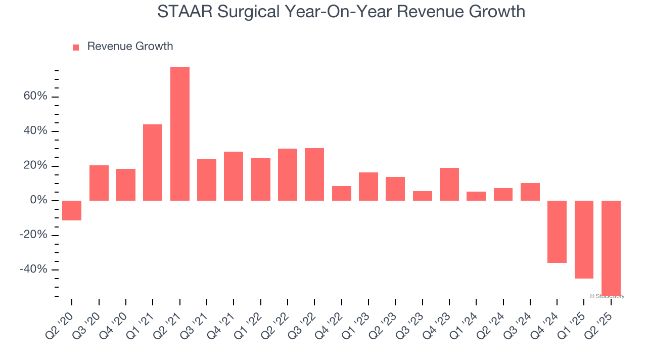 STAAR Surgical Year-On-Year Revenue Growth