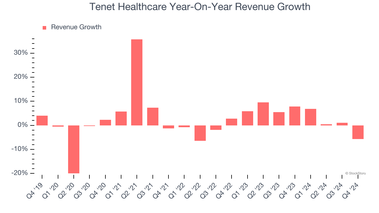 Tenet Healthcare Year-On-Year Revenue Growth