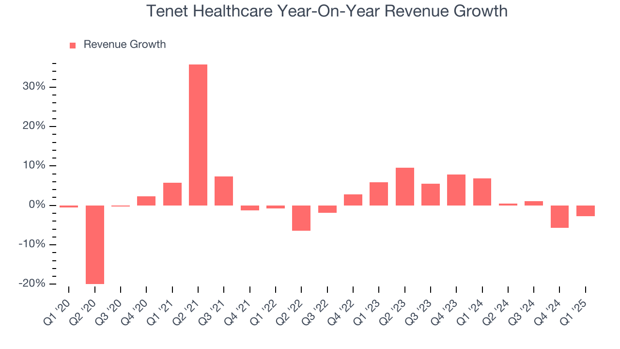 Tenet Healthcare Year-On-Year Revenue Growth