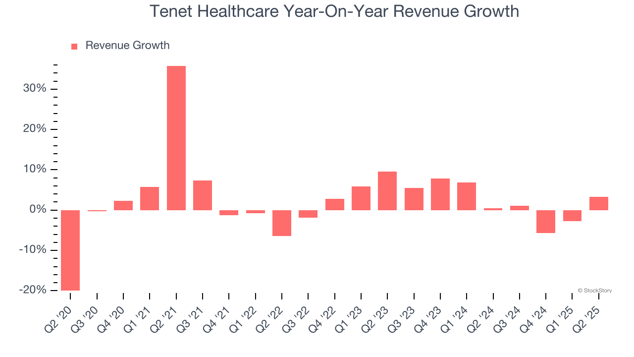 Tenet Healthcare Year-On-Year Revenue Growth