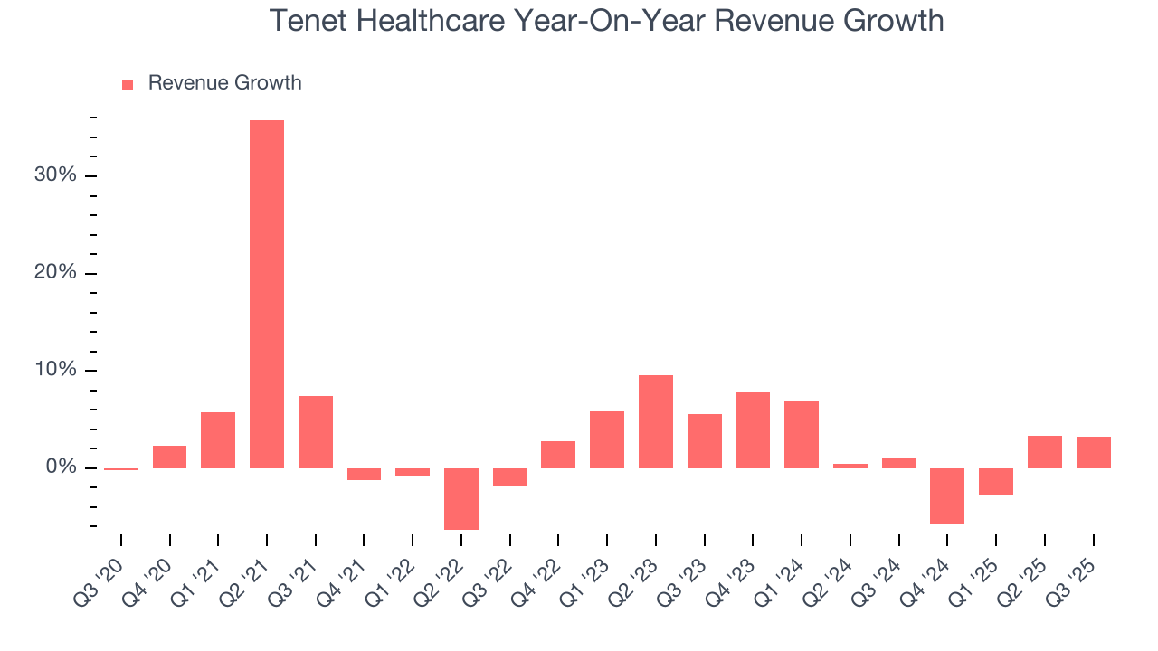 Tenet Healthcare Year-On-Year Revenue Growth