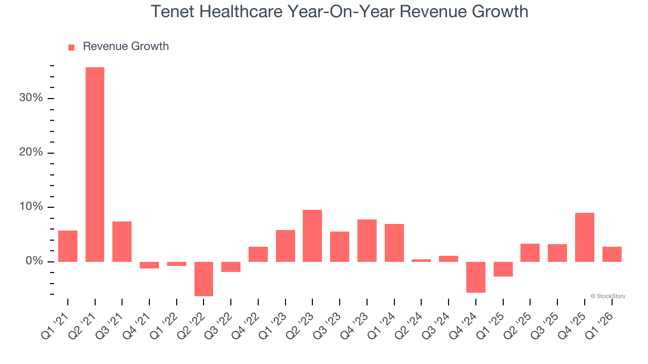 Tenet Healthcare Year-On-Year Revenue Growth