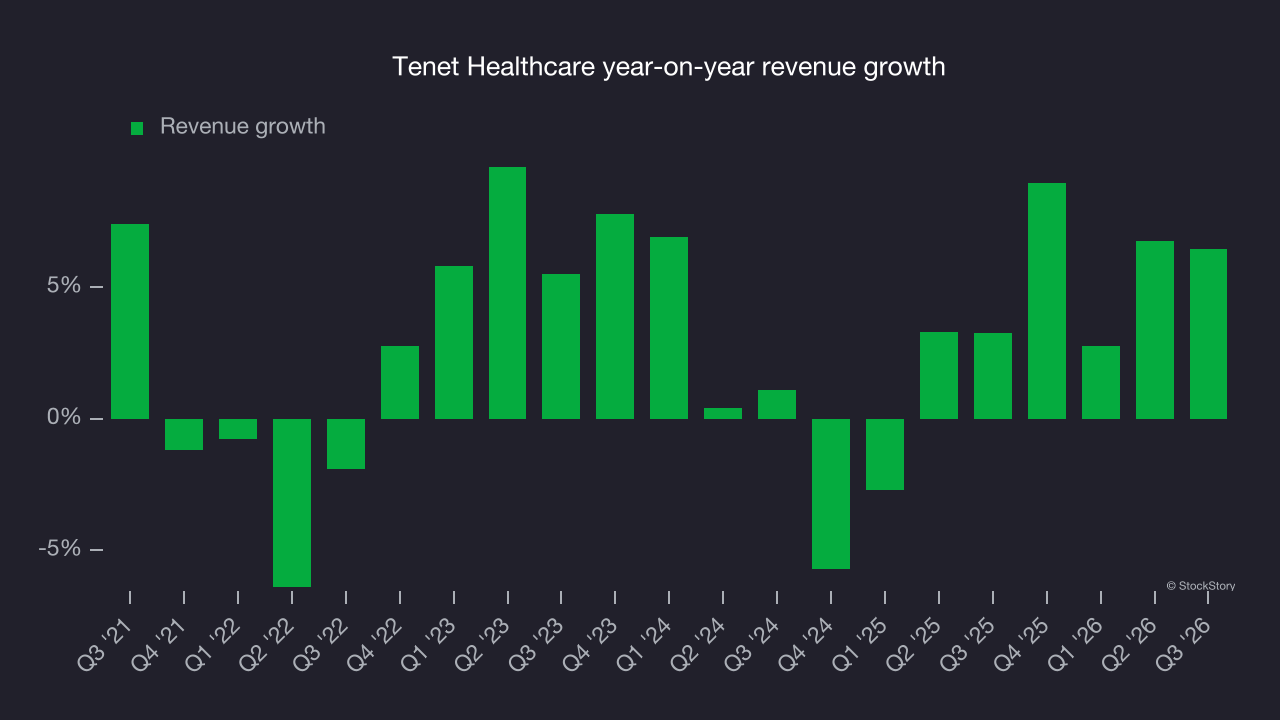 Tenet Healthcare year-on-year revenue growth